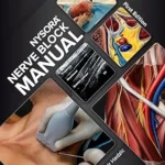 NYSORA Nerve Block Manual: First Edition