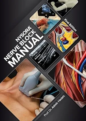 NYSORA Nerve Block Manual: First Edition